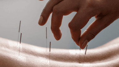 Image for Followup Acupuncture