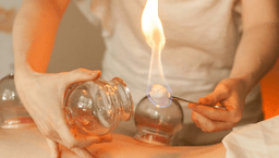 Image for Fire Cupping