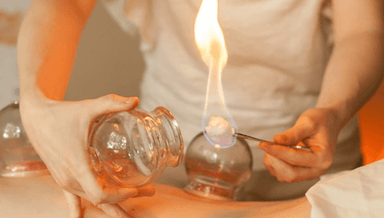 Image for Fire Cupping