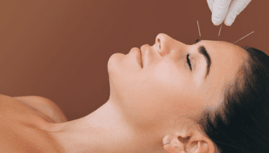 Image for Cosmetic Acupuncture/ Facial Rejuvination