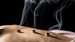 Image for Moxibustion