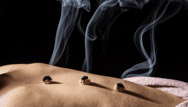 Image for Moxibustion